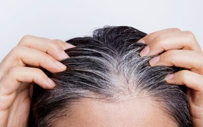 Penyebab Rambut Pitak dan 6 Cara Mengatasinya